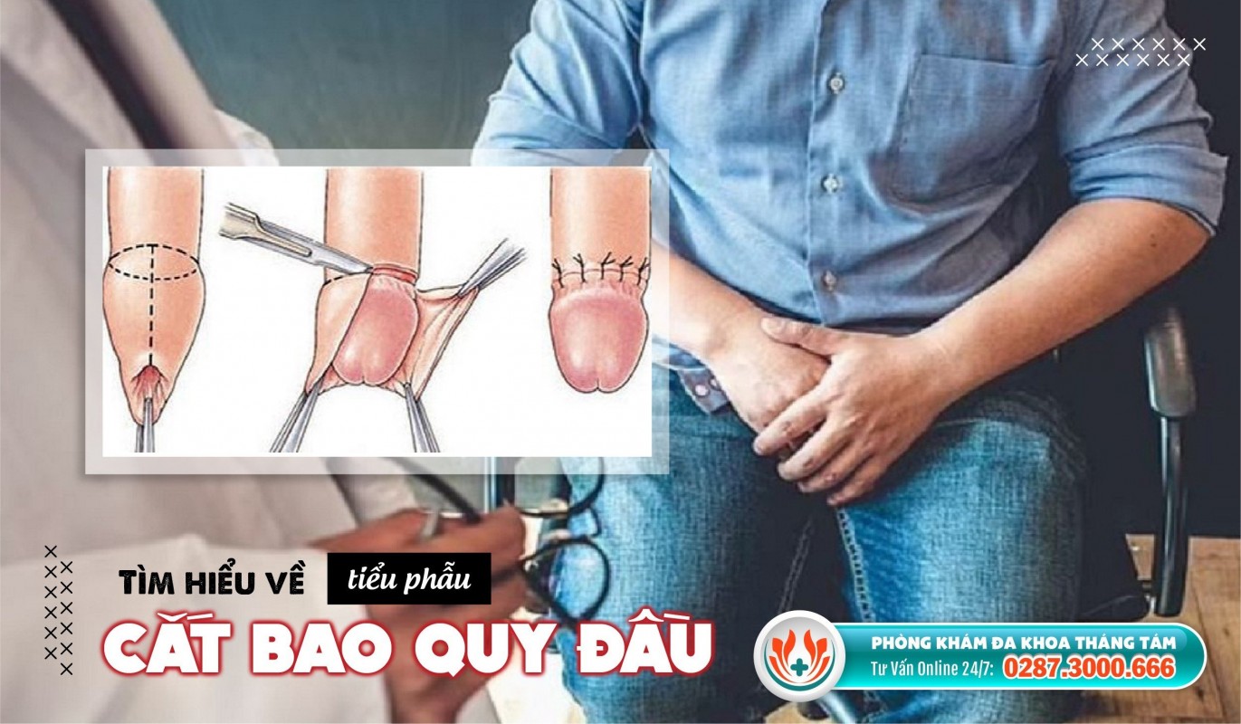 Khám phá 8 địa chỉ cắt bao quy đầu Thủ Đức an toàn, có chi phí tốt